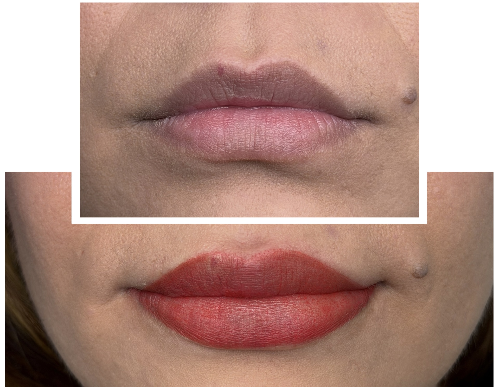 labios antesdespues